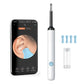 Smart Ear Cleaner with HD Camera